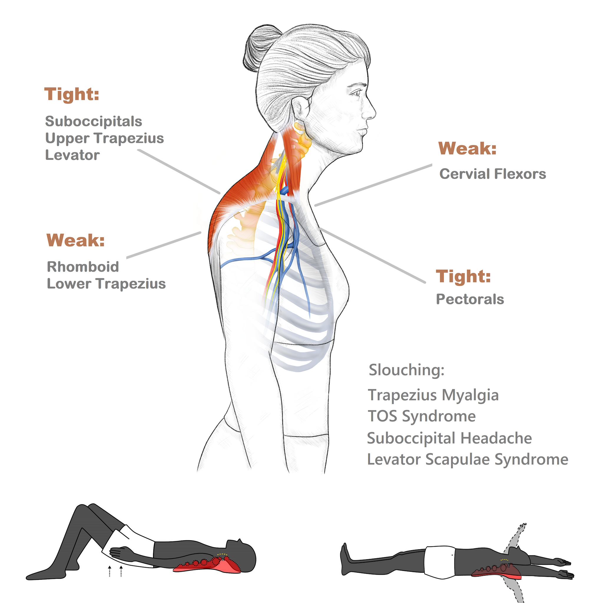 Trapezius muscle relaxation technique. #massage #massagetherapy #trape